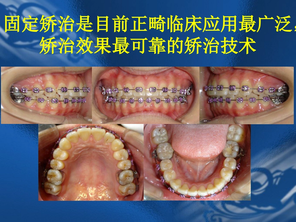 口腔正畸学课件[114页]_第2页