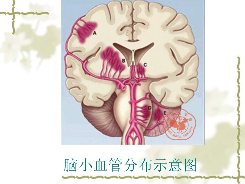 脑小血管病[30页]_第3页