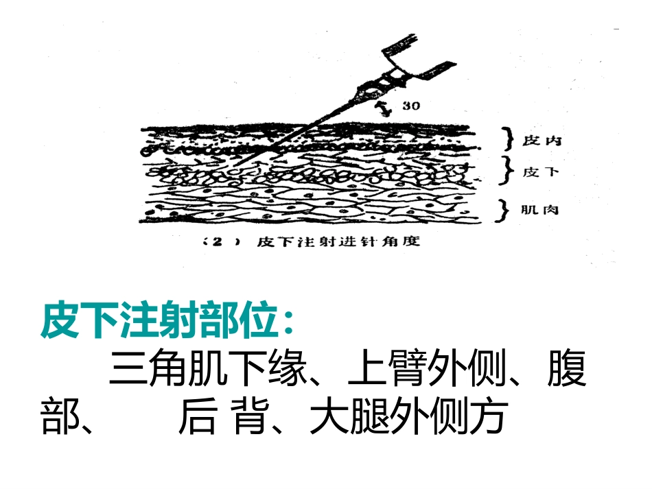 皮下注射法[15页]_第3页