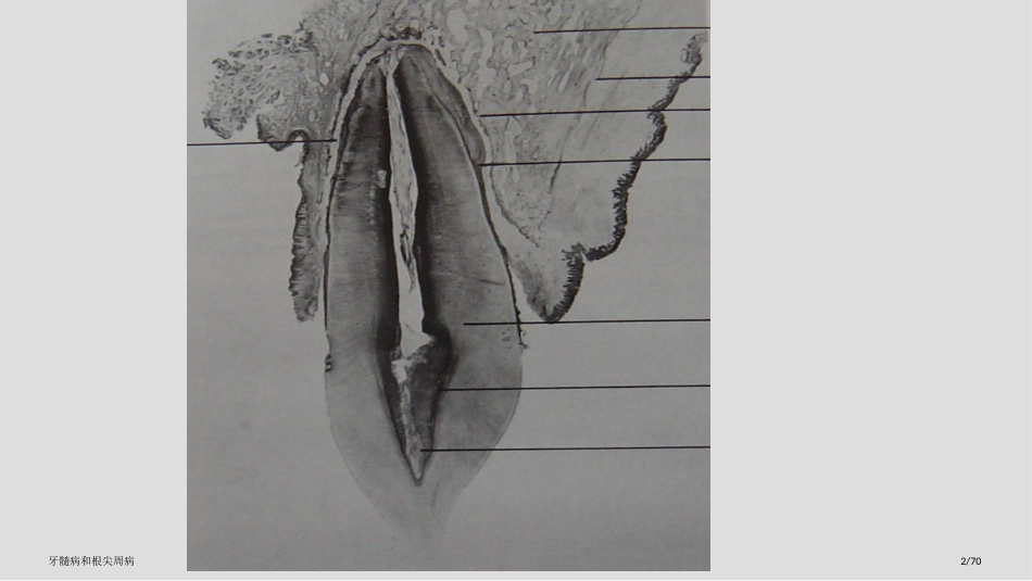 牙髓病和根尖周病_第2页