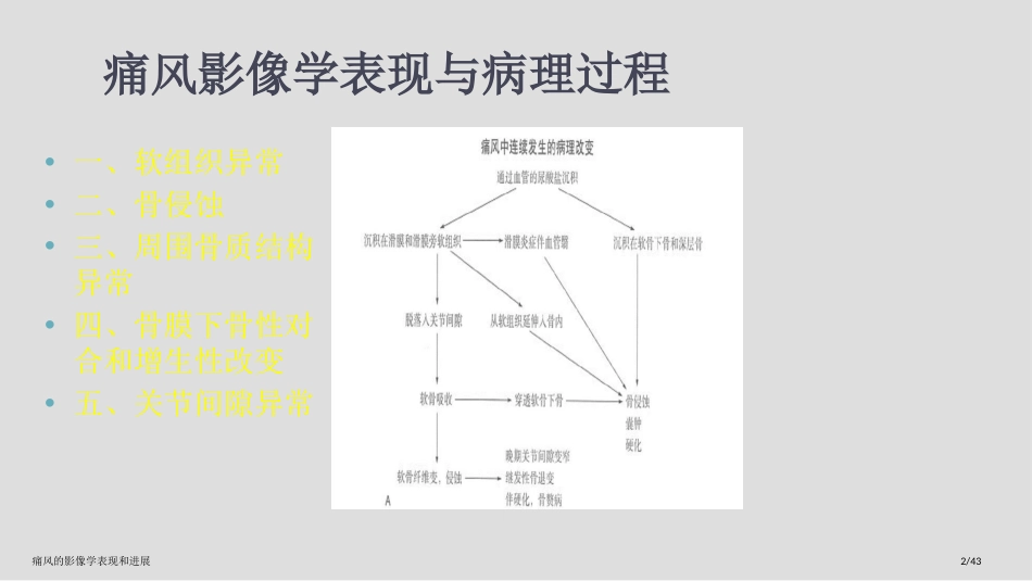 痛风的影像学表现和进展_第2页