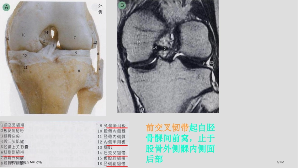 膝关节解剖及MRI诊断_第3页