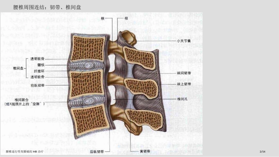 腰椎退行性变腰痛的MR诊疗_第3页