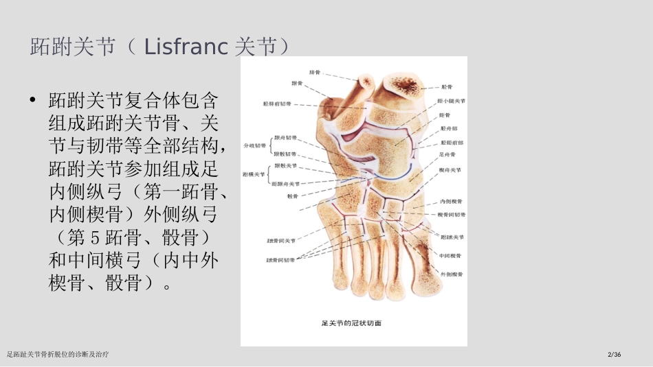 足跖趾关节骨折脱位的诊断及治疗_第2页