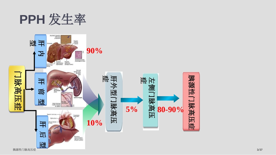 胰源性门脉高压症_第3页