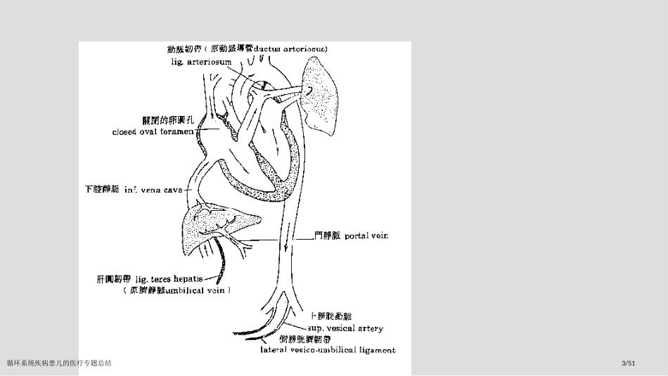 循环系统疾病患儿的医疗专题总结_第3页