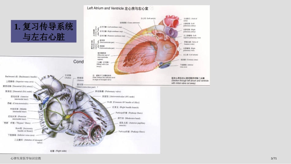 心律失常医学知识宣教_第3页