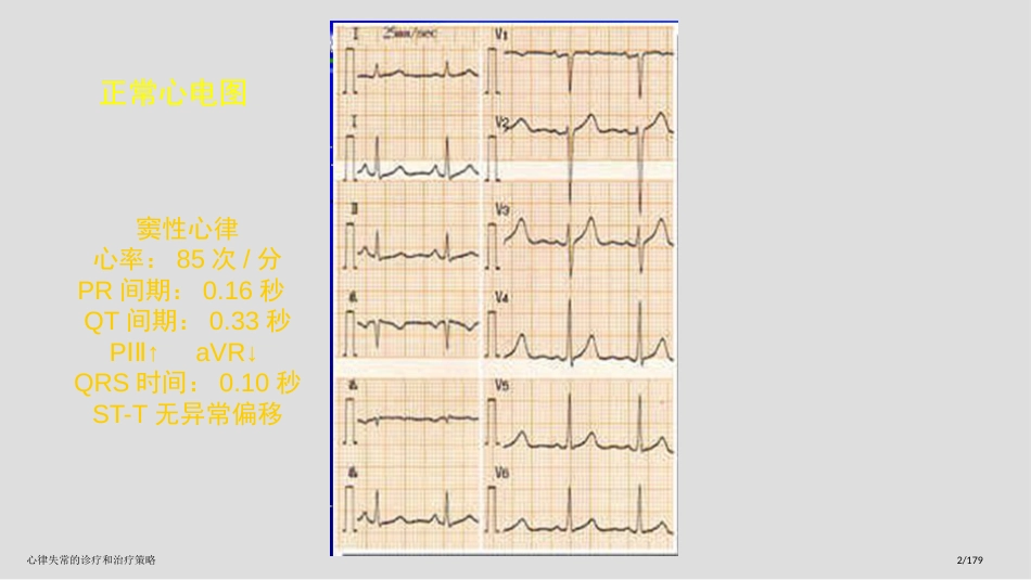心律失常的诊疗和治疗策略_第2页