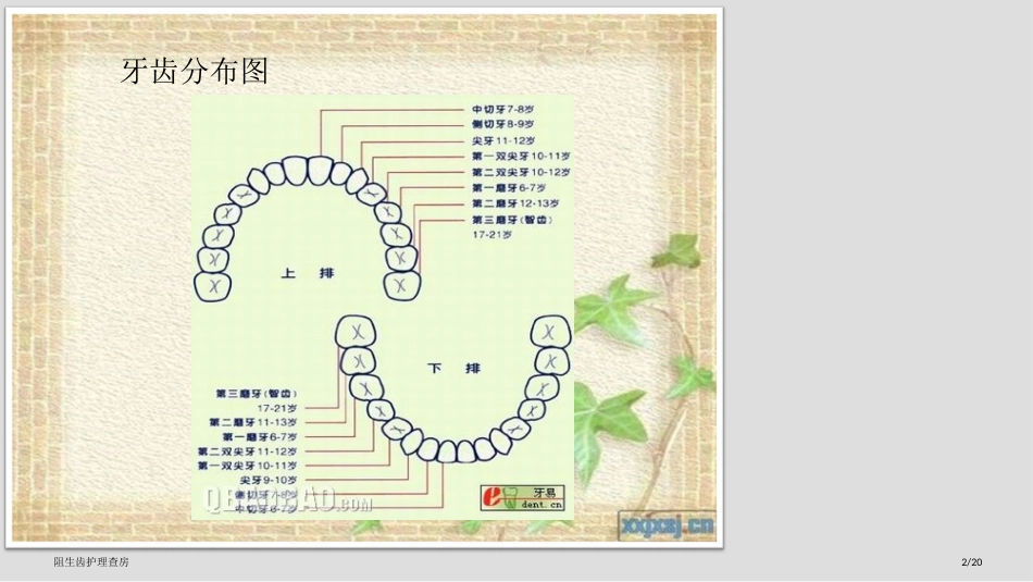 阻生齿护理查房_第2页