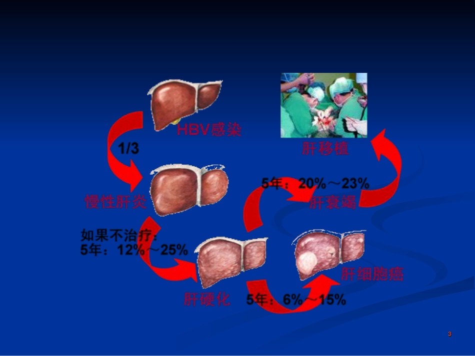 乙肝病毒母婴阻断_第3页