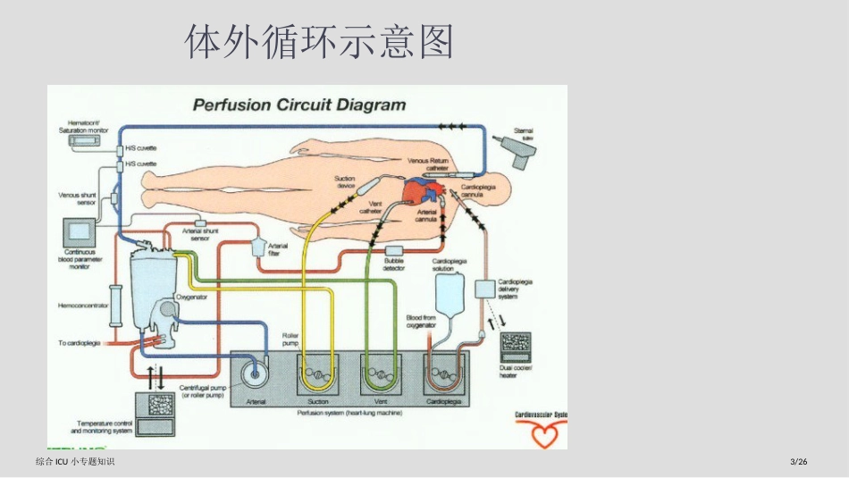 综合ICU小专题知识_第3页