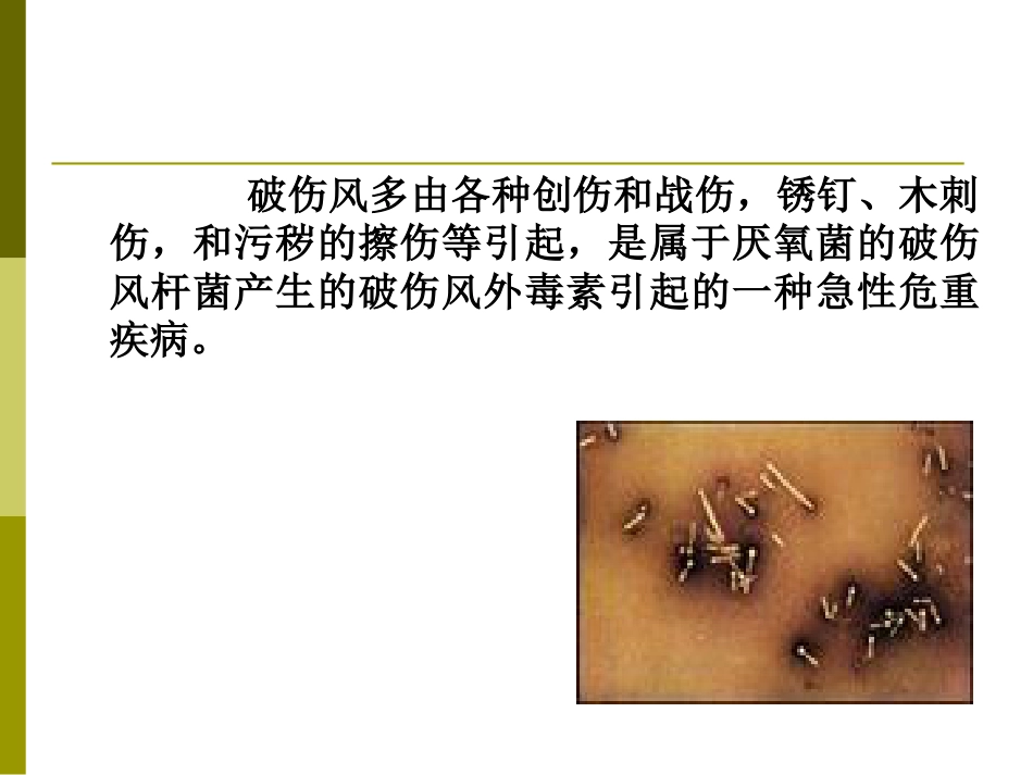 破伤风抗毒素TAT工作流程及皮试方法的改进_第2页