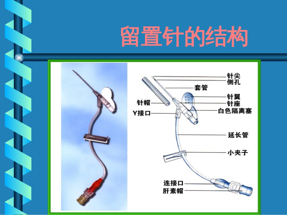 静脉留置针的临床应用及护理详解_第3页