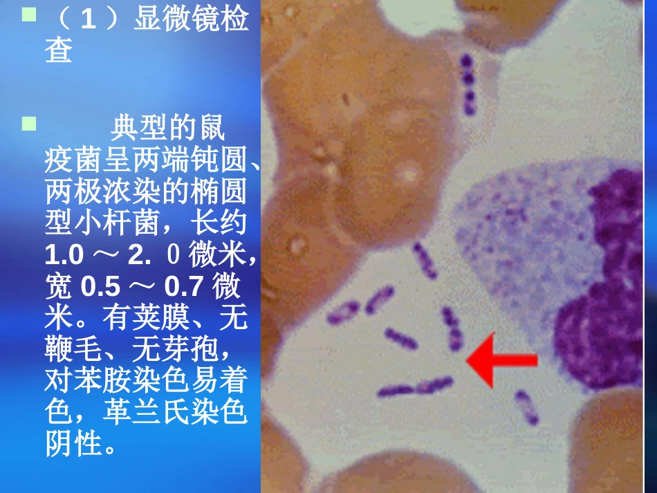 鼠疫的预防和控制[80页]_第3页