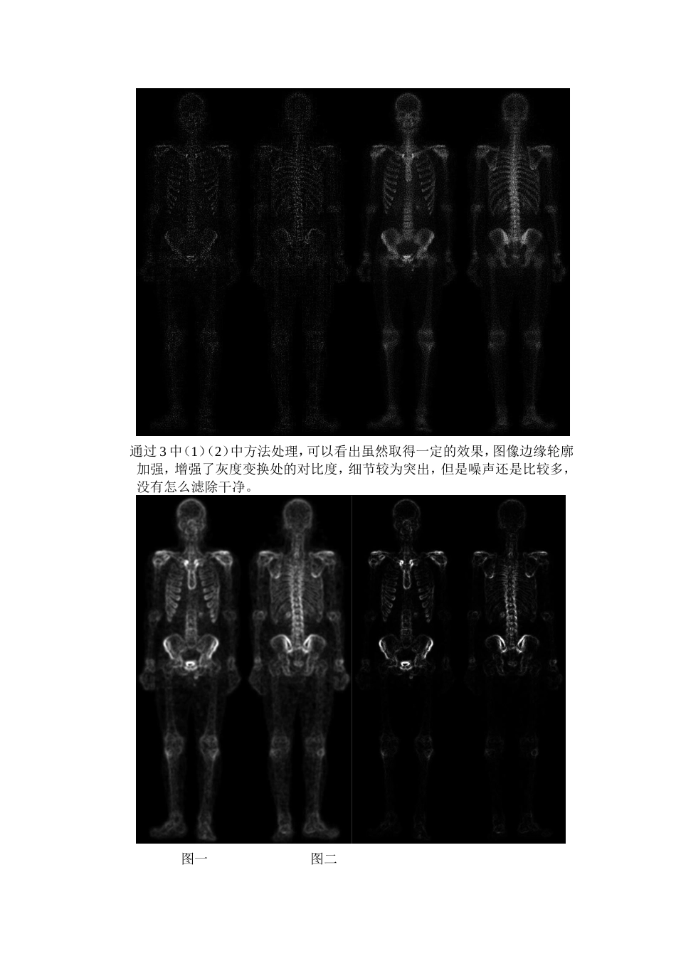 图像锐化处理实验报告_第3页