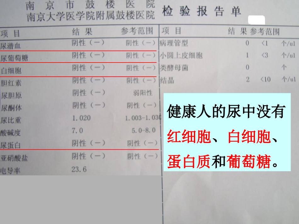 吉林省长春市七年级生物下册 4.5.1人体内废物的排出课件1 新人教版_第3页