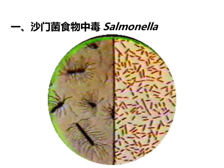 (27)--4、常见的细菌性食物中毒_第1页