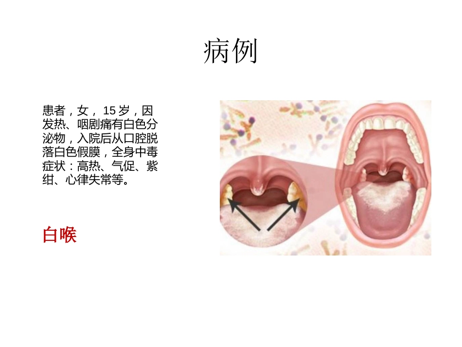 (36)--蛋白质合成的干扰和抑制_第2页