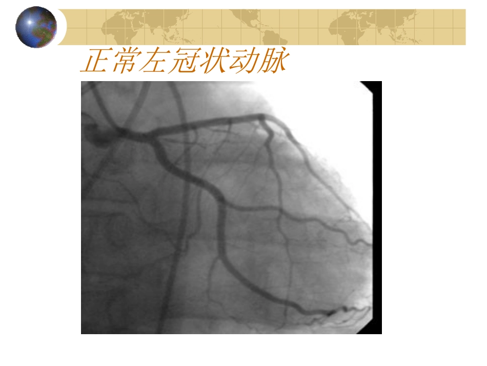 冠状动脉造影结果判定[共116页]_第3页