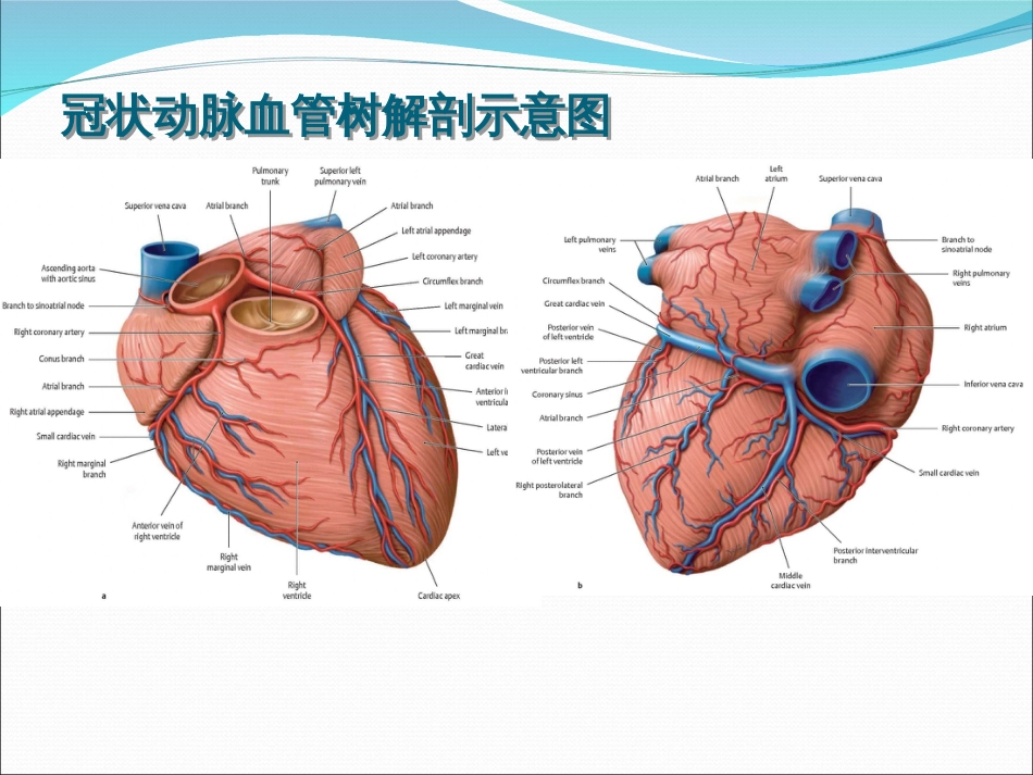 冠状动脉造影识图[共45页]_第2页