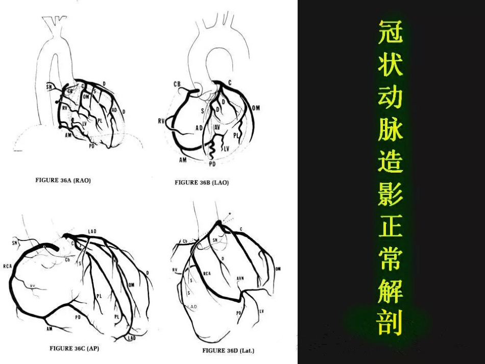 冠状动脉解剖精细到每一个分段[共34页]_第2页