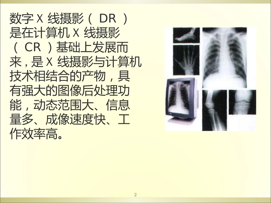 DR摄影技术几点体会ppt课件[共31页]_第2页