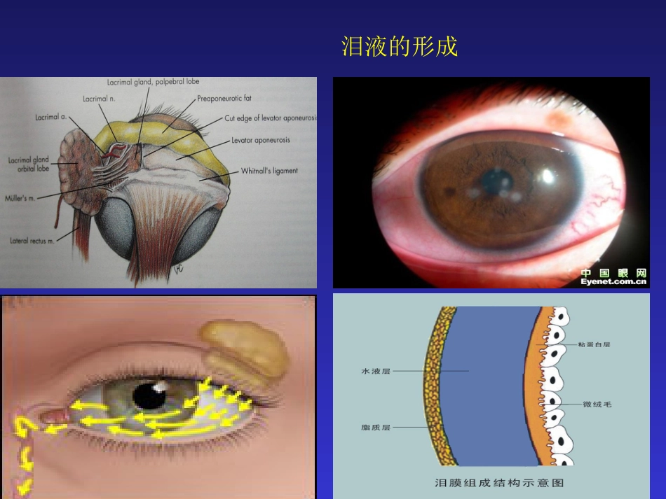 干眼症的防治PPT课件_第3页