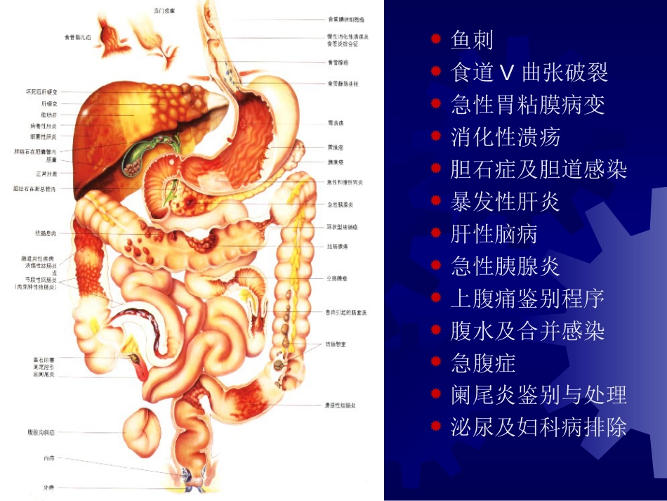 研究生消化急症讲座[共100页]_第2页