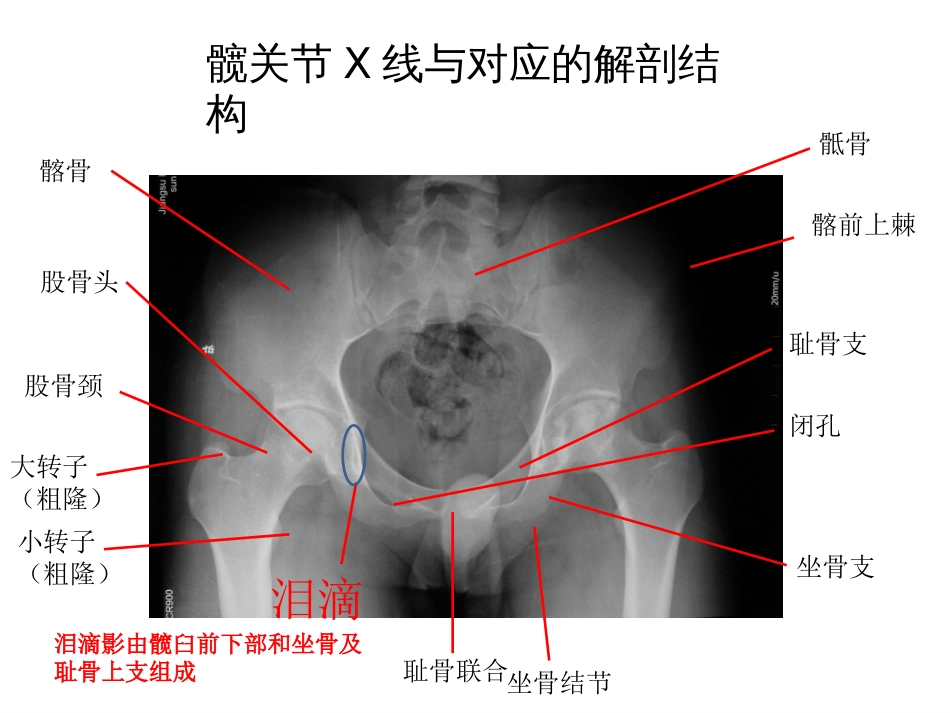 全髋关节置换术中的精确重建[共70页]_第2页