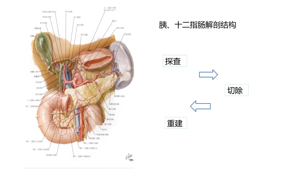 胰十二指肠切除术术式图解2010[14页]_第2页