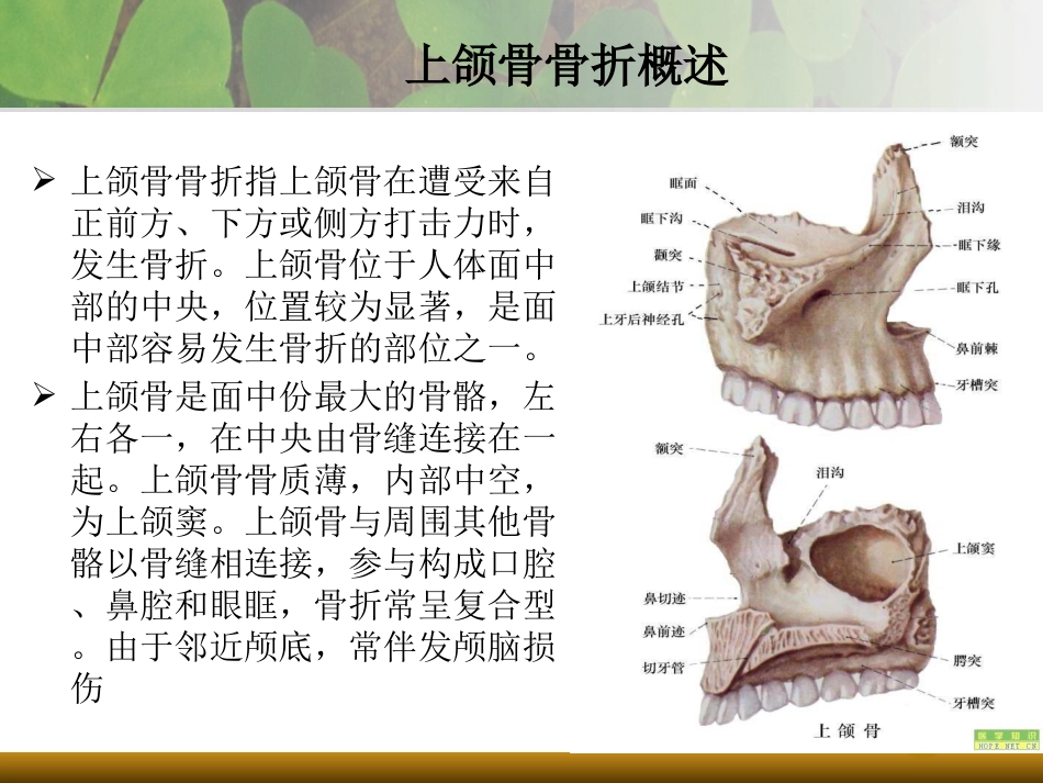 上下颌骨骨折[共21页]_第3页