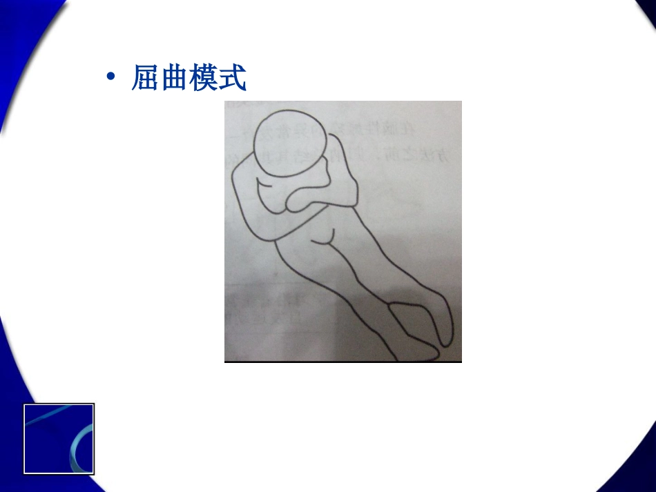 各类型脑瘫神经发育学治疗[共37页]_第3页