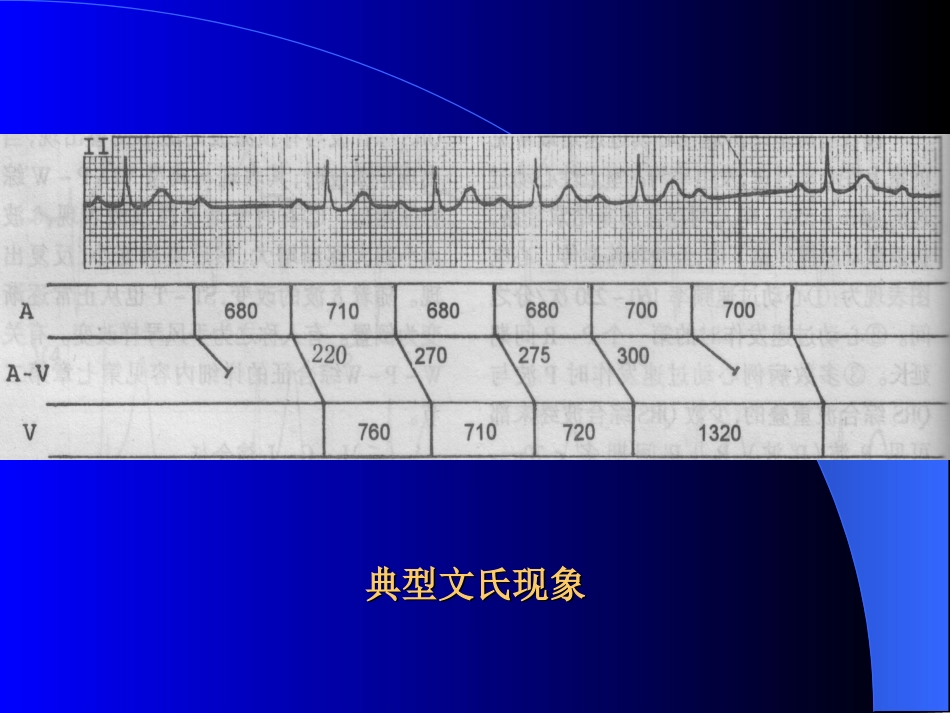 典型文氏现象_第1页