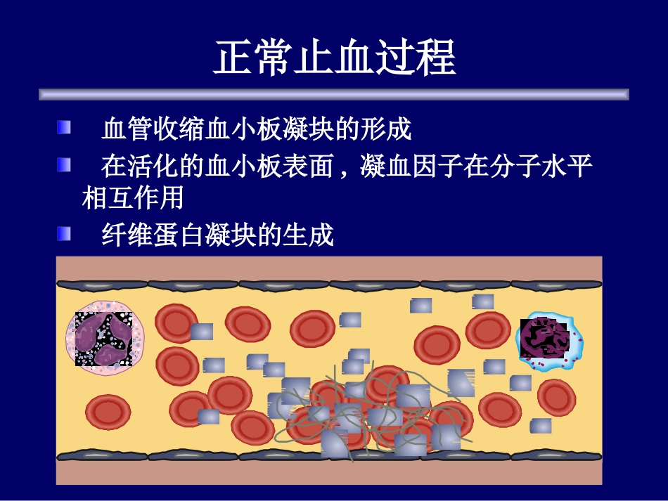 冯莹 基因重组活化VII因子的临床应用[共43页]_第2页