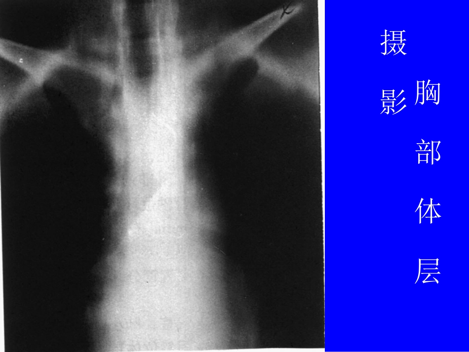 呼吸系统实习片库[共79页]_第3页