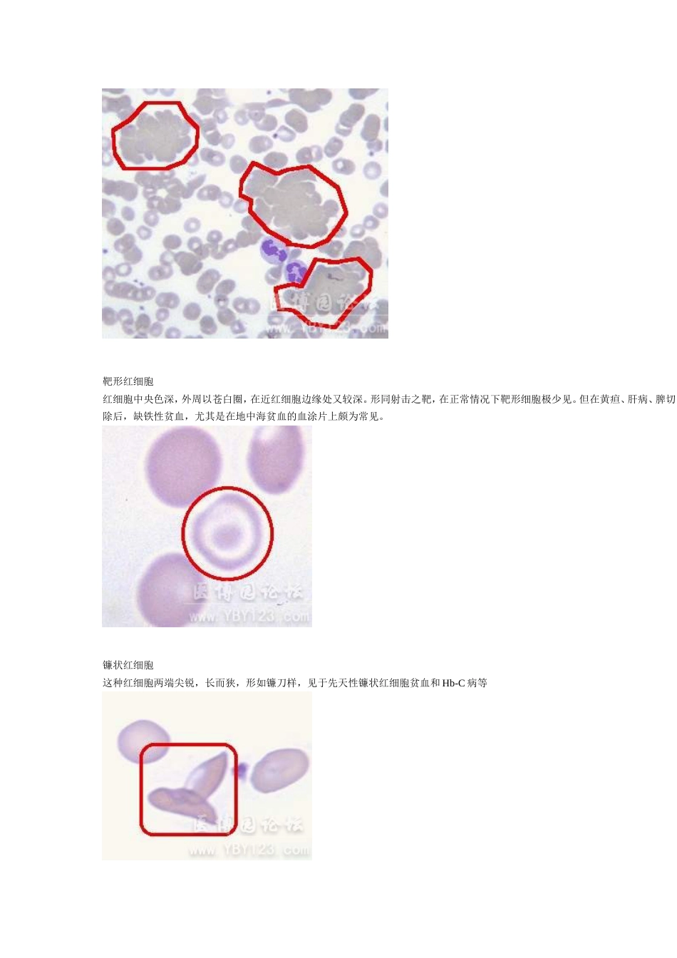 各种血细胞模式图[共11页]_第2页