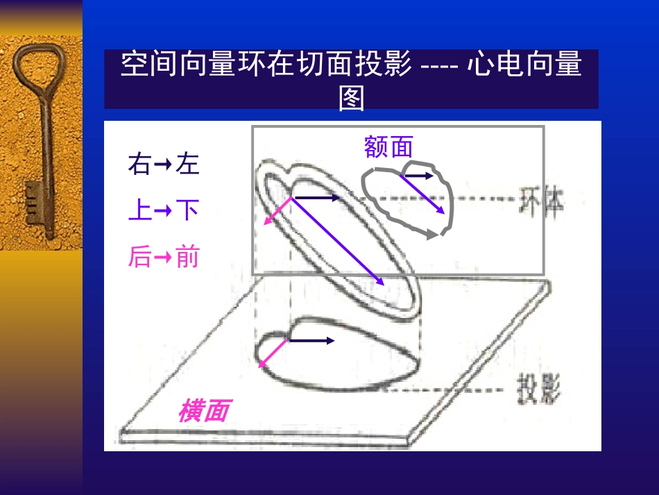 常见心电图诊断要点[共73页]_第3页