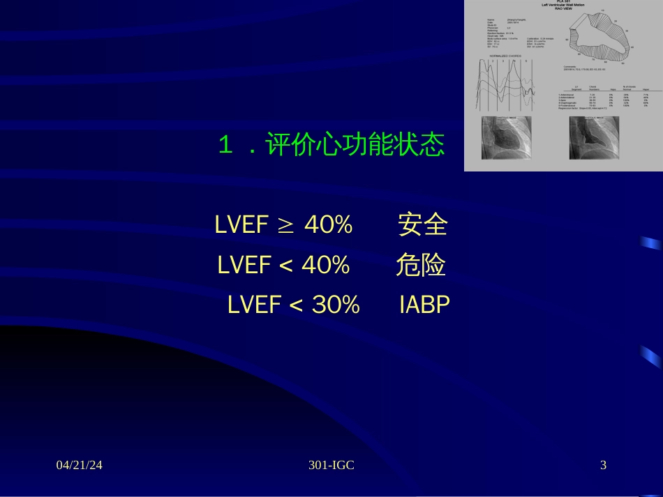 冠心病介入治疗操作要点和并发症防[共71页]_第3页