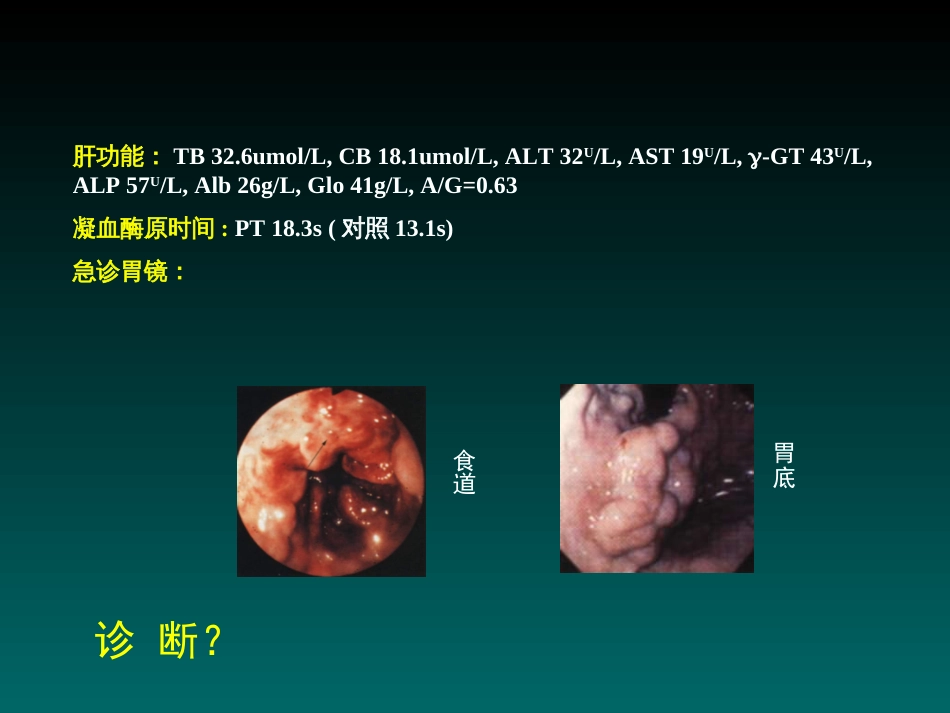 肝硬化课件[共107页]_第3页