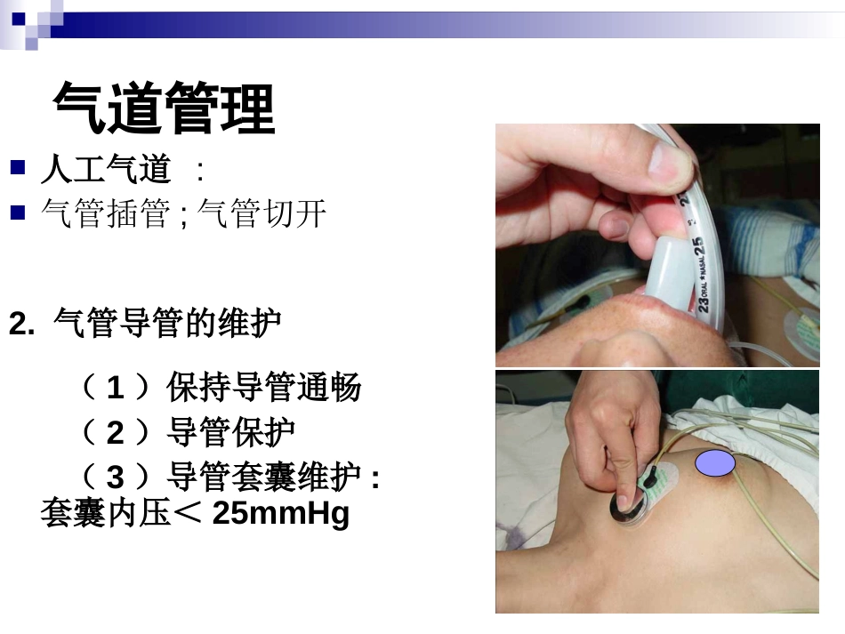 机械通气常用模式[共96页]_第3页