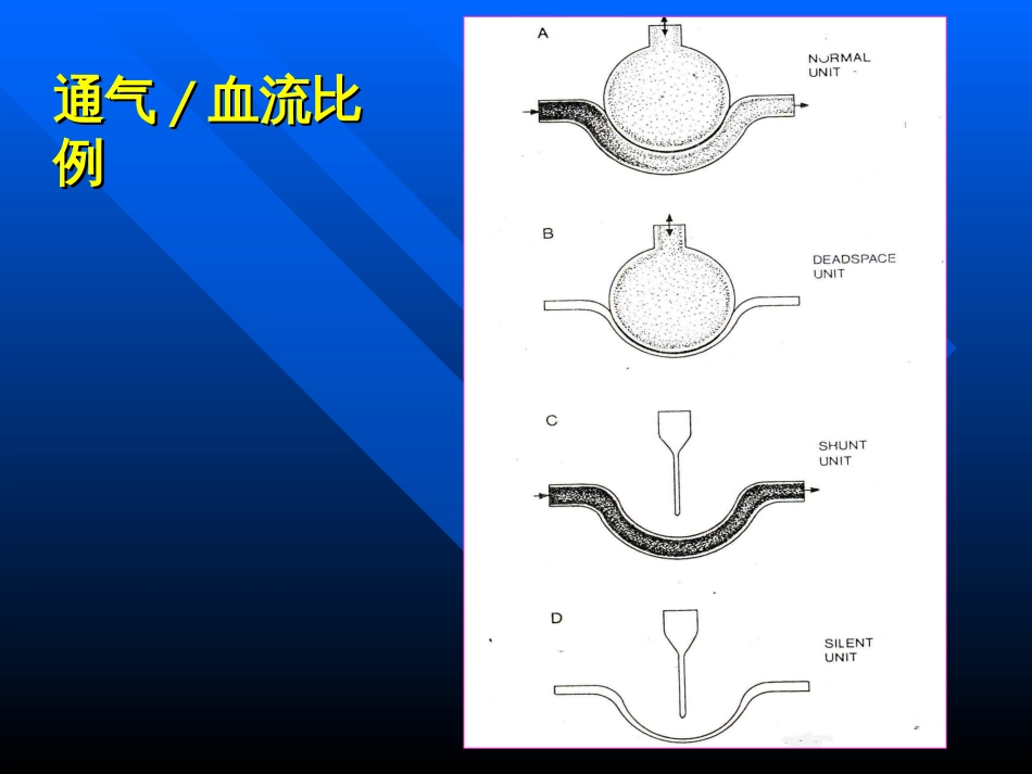 血气分析常用指标[共26页]_第3页