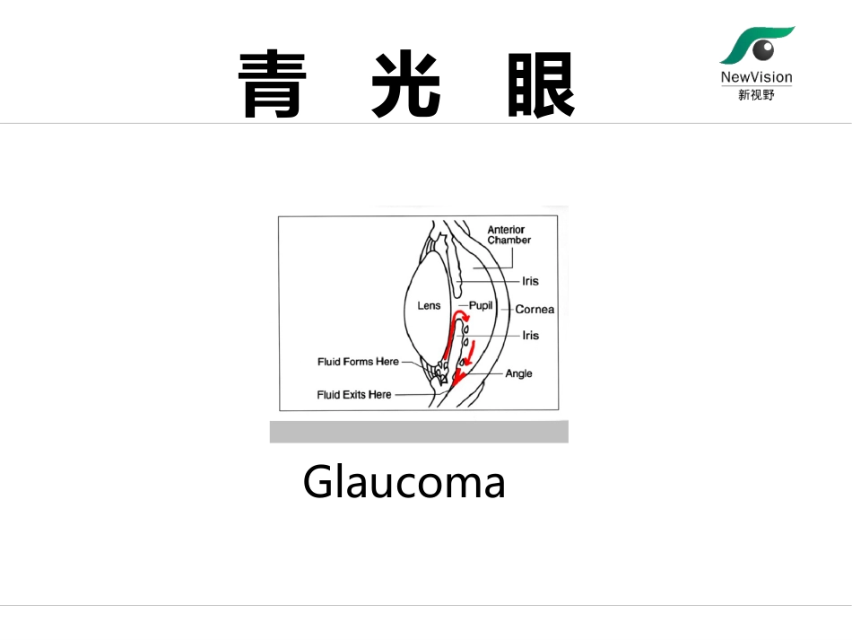 青光眼基础知识[共51页]_第2页