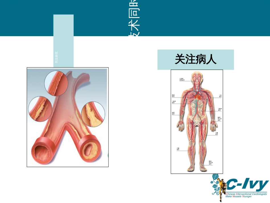 ACS患者他汀序贯治疗策略_第3页