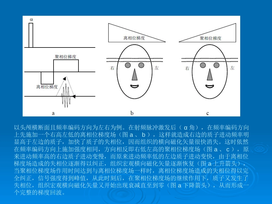 GRE梯度回波序列的原理与临床[共24页]_第3页