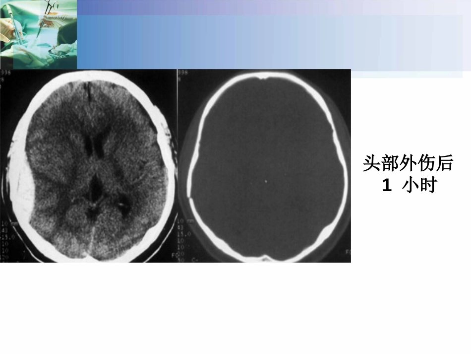 CT读片练习[共52页]_第2页