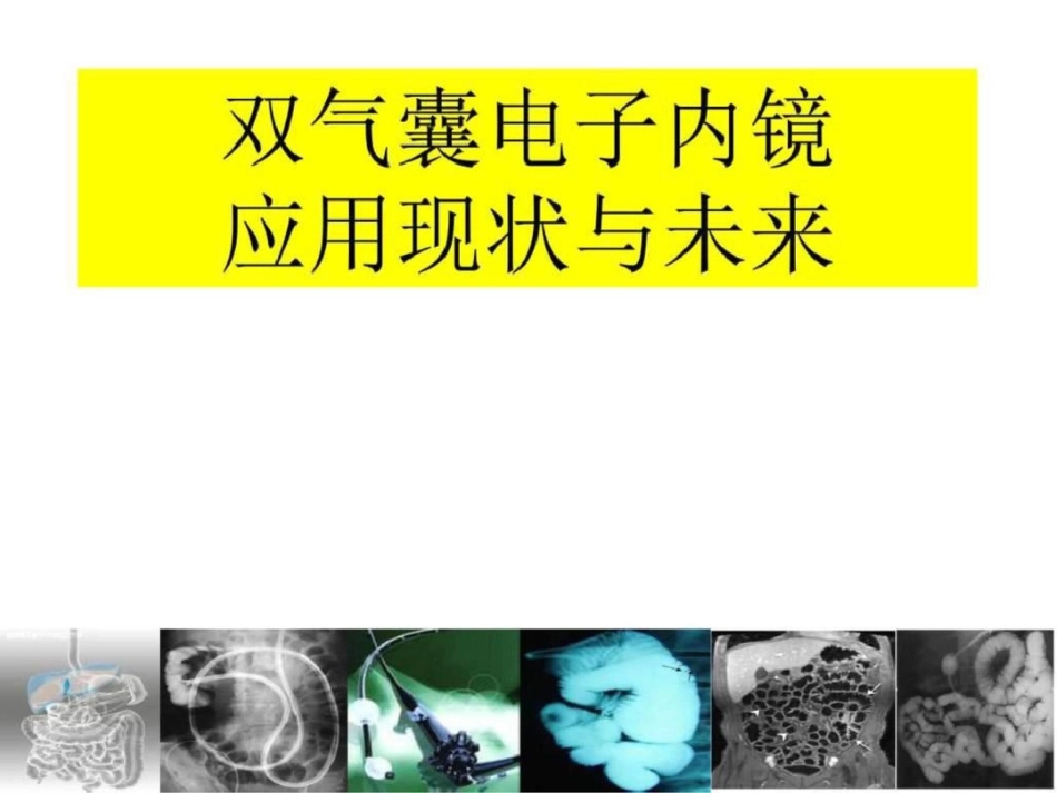 电子小肠镜应用的现状与未来图文.ppt文档资料_第1页