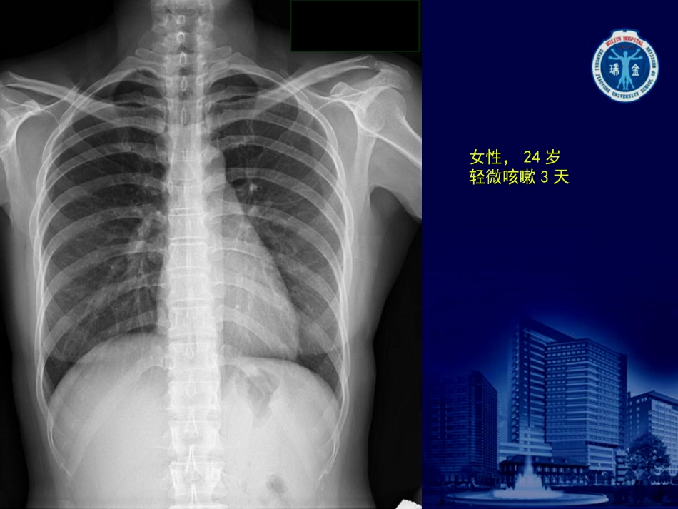 X线读片练习[共95页]_第1页