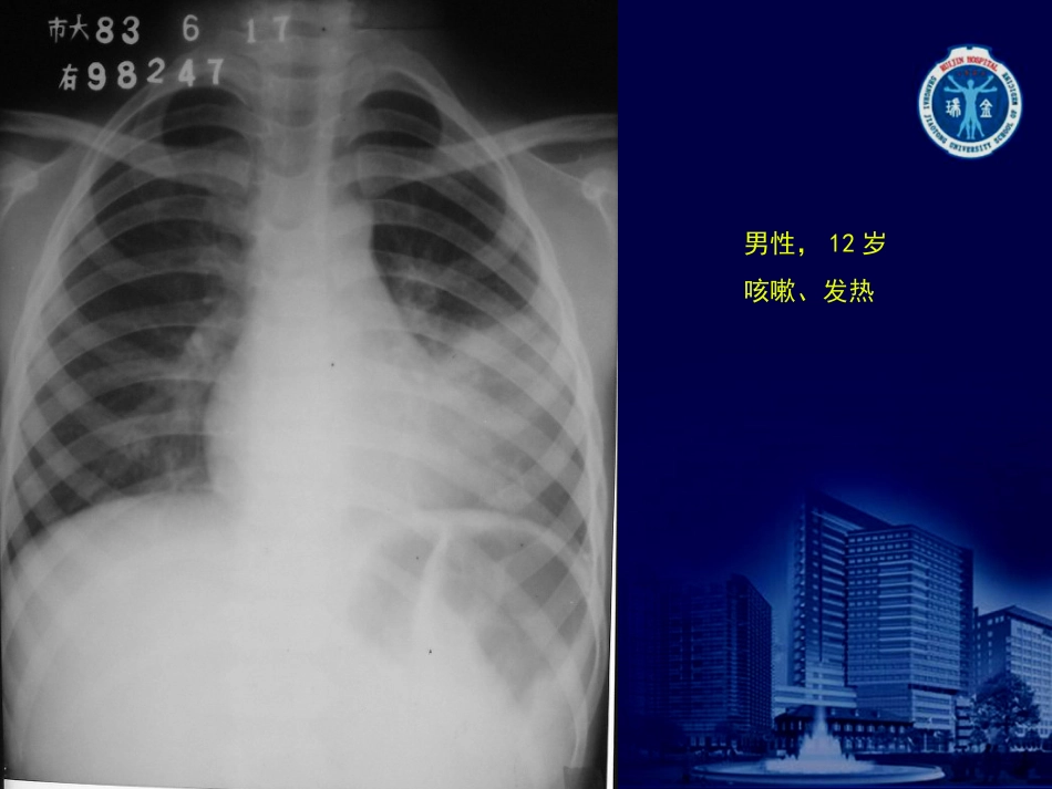 X线读片练习[共95页]_第3页