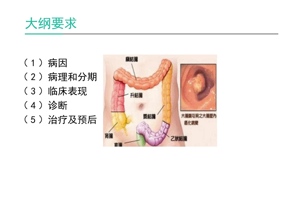 第三十三章结、直肠癌[共62页]_第3页