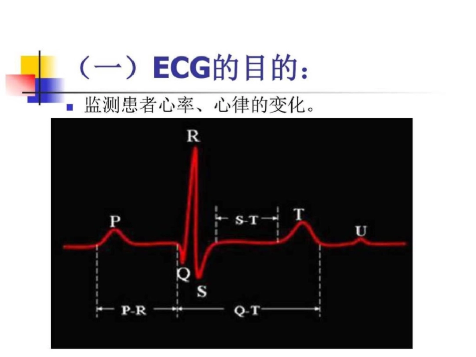 心电监测技术图文._第3页